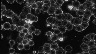 Live Blood Cell Analysis with Andrea Maxim, ND