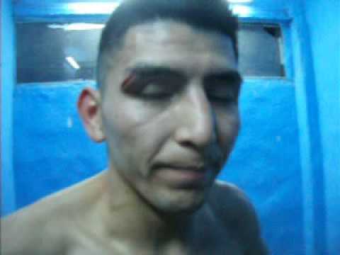 EL GARINENSE TV: Nota a German Benitez después de la perdida del titulo