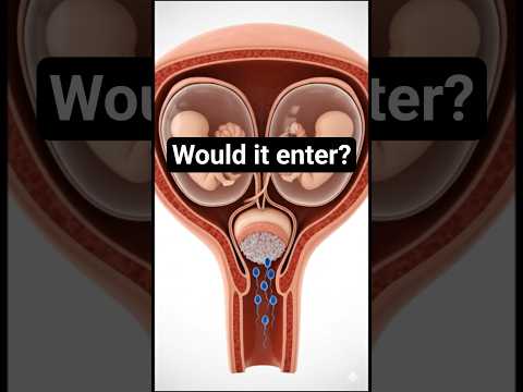 Twin Pregnancy in the Womb | Unborn Baby Development