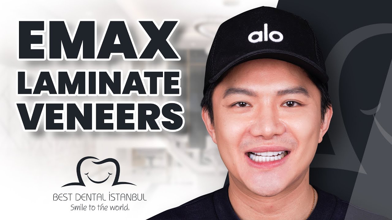 Emax Laminate Veneers: The Secret to Perfect Smiles
