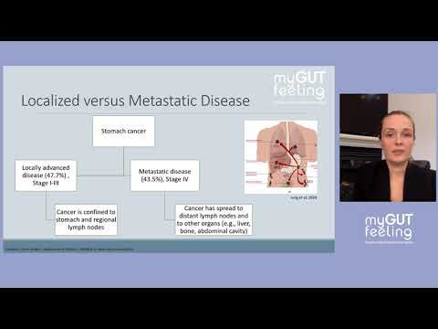 2 Dr. Elena Elimova, Medical Oncologist,  Gastric Cancer Care & Research: Where are we now?