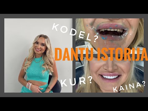 VLOGAS #58 / DANTU ISTORIJA? KAIP, KODEL IR KUR?