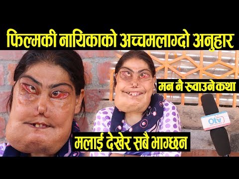 मलाई देखेर सबै भाग्छन् - ८२ बर्षिय आमा पर्खेर बस्नु हुन्छ ! नायिकाको अच्चमलाग्दो अनुहार - Kumari