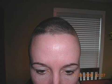 How long before hair starts to grow after chemo? - Page 2 — Cancer Survivors Network How long before hair starts to grow after chemo? - Page 2 — Cancer Survivors Network