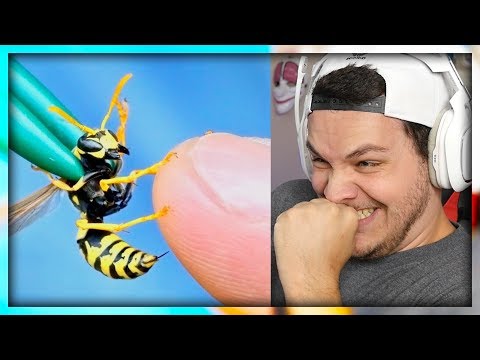 STUNG by a YELLOW JACKET! - Reaction
