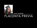 Placenta Previa Nursing