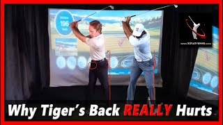 Understanding Tiger Woods' Back Pain and Its Solutions
