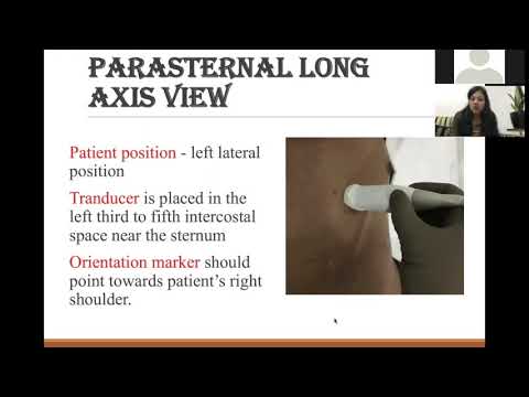 ECHO MASTER CLASS 1: TRANS-THORACIC VIEWS AND IDENTIFICATION OF CHAMBERS BY DR AMARJA NAGREA