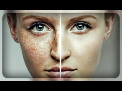Веснушки для фш Темные пятна на лице как избавиться народными средствами
