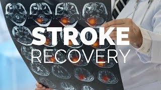 Stroke Recovery | What You Didn't Know About Dental Health Home Care