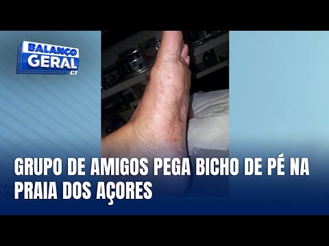 24 amigos contraem bicho de pé e bicho geográfico na Praia dos Açores
