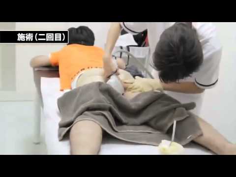 หน้าอกหย่อนคล้อยพลาสติก หน้าอกเล็กสีบลอนด์โป๊