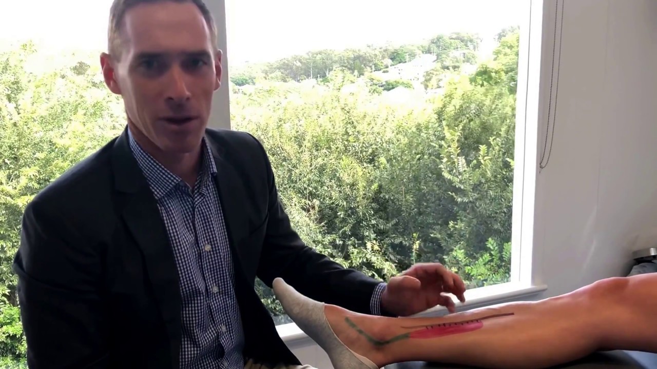 Shin Splints Explained (Medial Tibial Stress Syndrome)