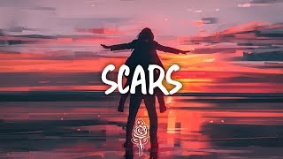Hazey Eyes - Scars (Lyrics) ft. Yoke Lore