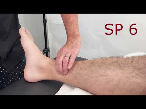 McMaster Medical Acupuncture Program: SP 6 Point Demonstration