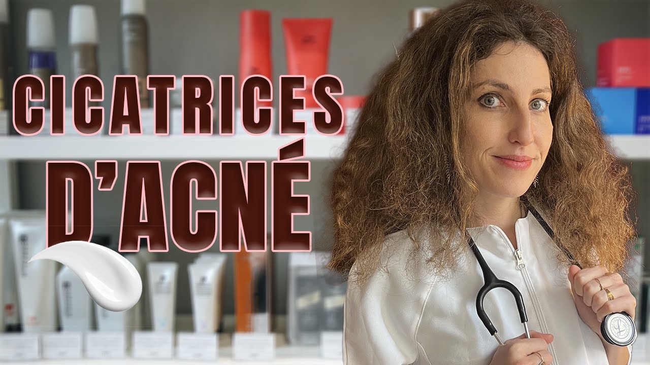 ENLEVER LES CICATRICES D'ACNÉ, oui mais comment ?