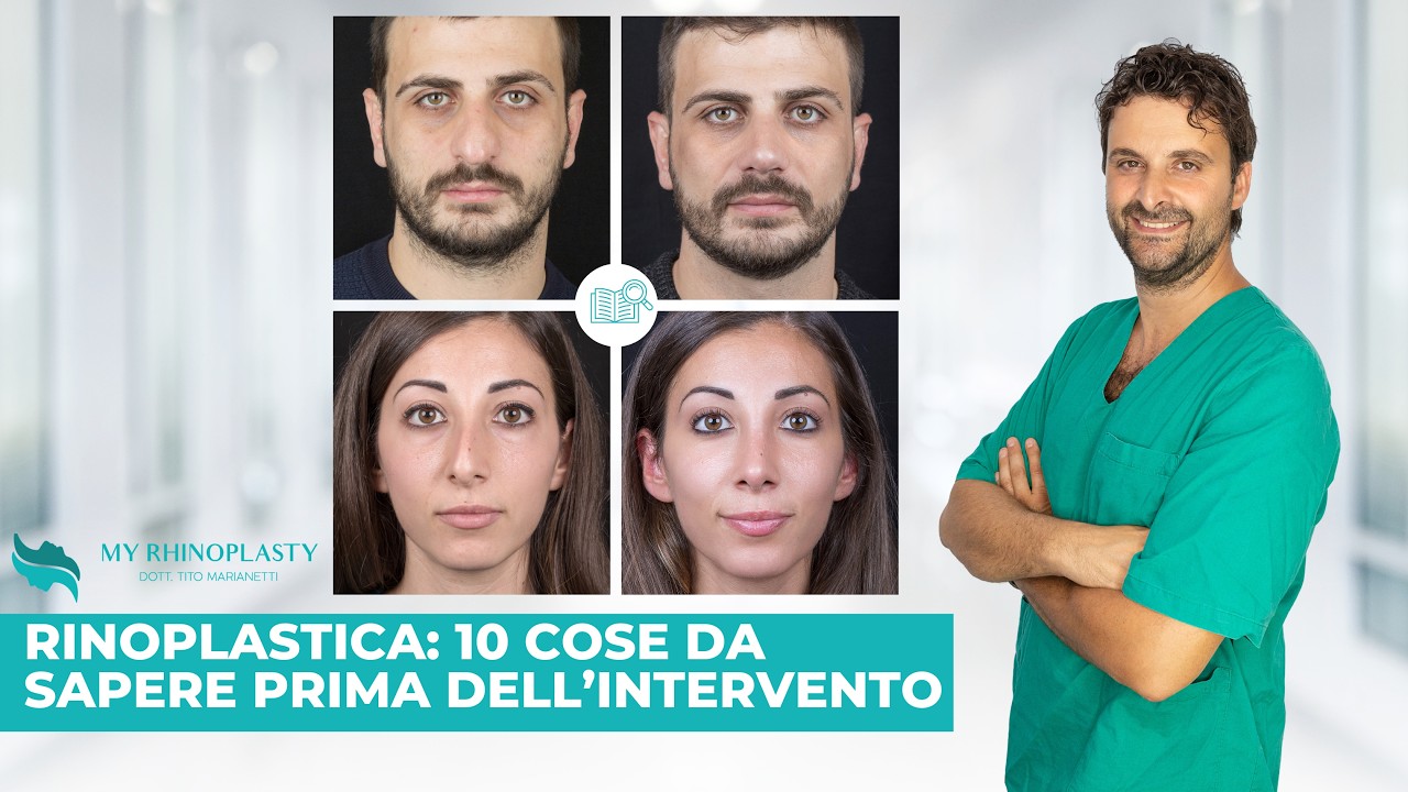 Rinoplastica: 10 cose da sapere prima dell’intervento