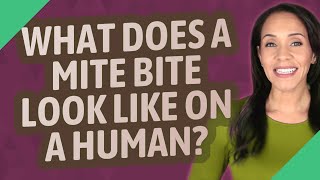 What does a mite bite look like on a human