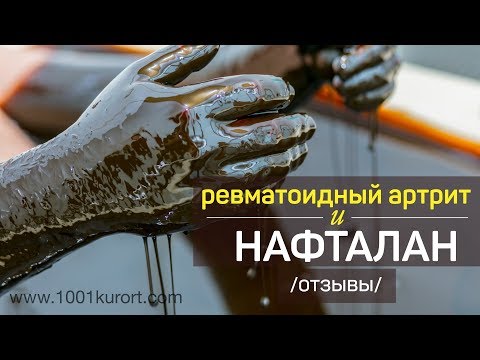Сколиоз грудного отдела позвоночника последствия Жутко болит спина и шея