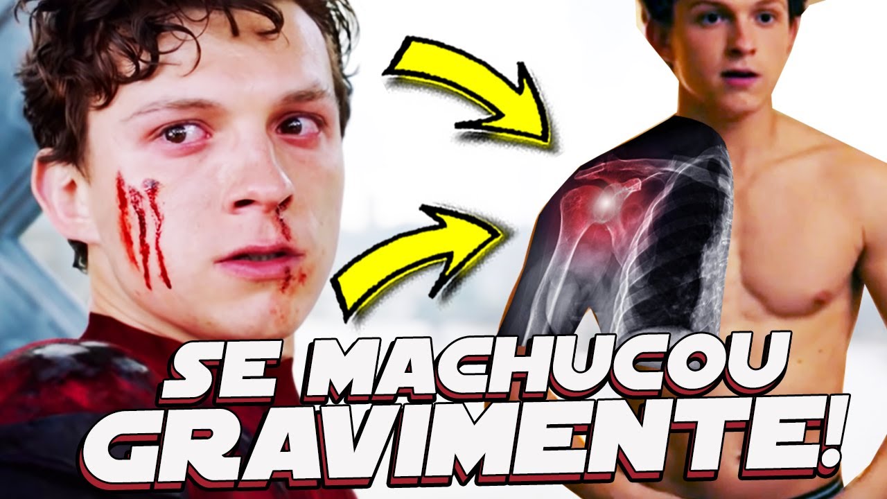 10 ATORES QUE SE MACHUCARAM GRAVEMENTE NOS FILMES