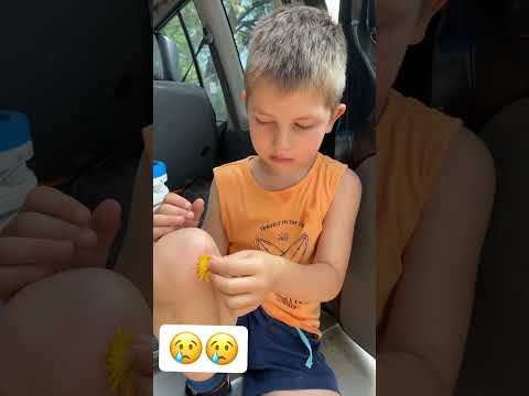 Tomi balesetett szenvedett 😢😢 #shorts