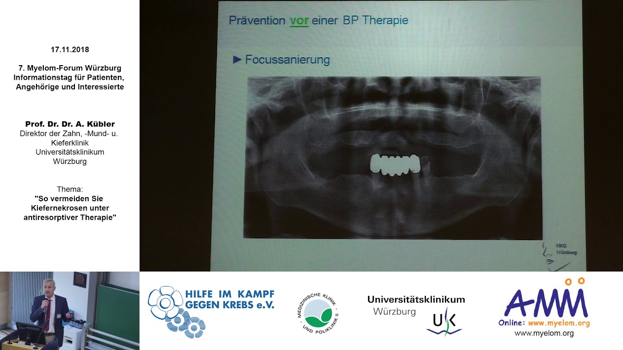 Kiefernekrosen unter antiresorptiver Therapie
