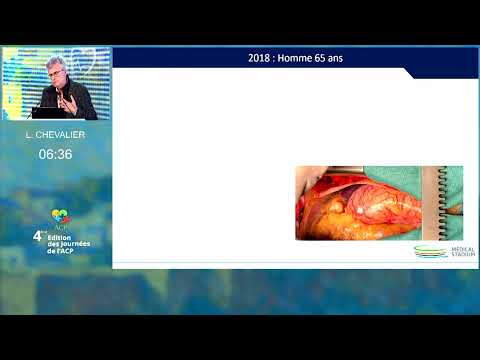 Valvulopathies Et Pratique Sportive éligible ou non ?  