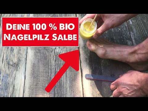 Wie die Nägel auf den Händen auf gribok zu prüfen Wie gribok die Füsse der Beine des Fotos zu behandeln