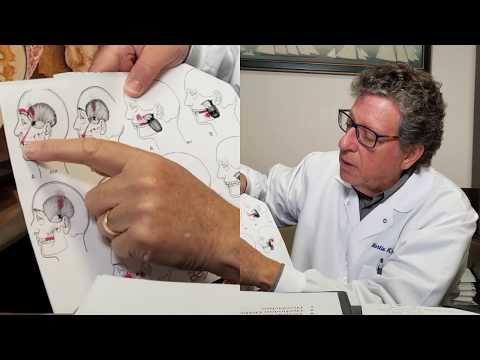 Correlation of TMJ, Dental Malocclusion, and Headaches (4 B's: Bite)