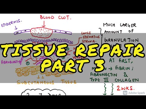 GENERAL PATHOLOGY II CHAP 3 II INFLAMMATION REPAIR II PART 1 II ROBBINS 10TH EDITION