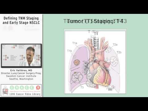 Defining TNM Staging and Early Stage NSCLC