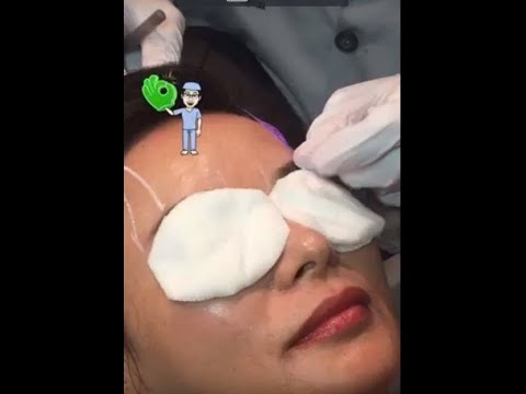 Injectable Fillers to the Face