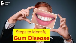 How can I tell if I have gingivitis or periodontitis (gum disease)? - Dr. Chandan Mahesh