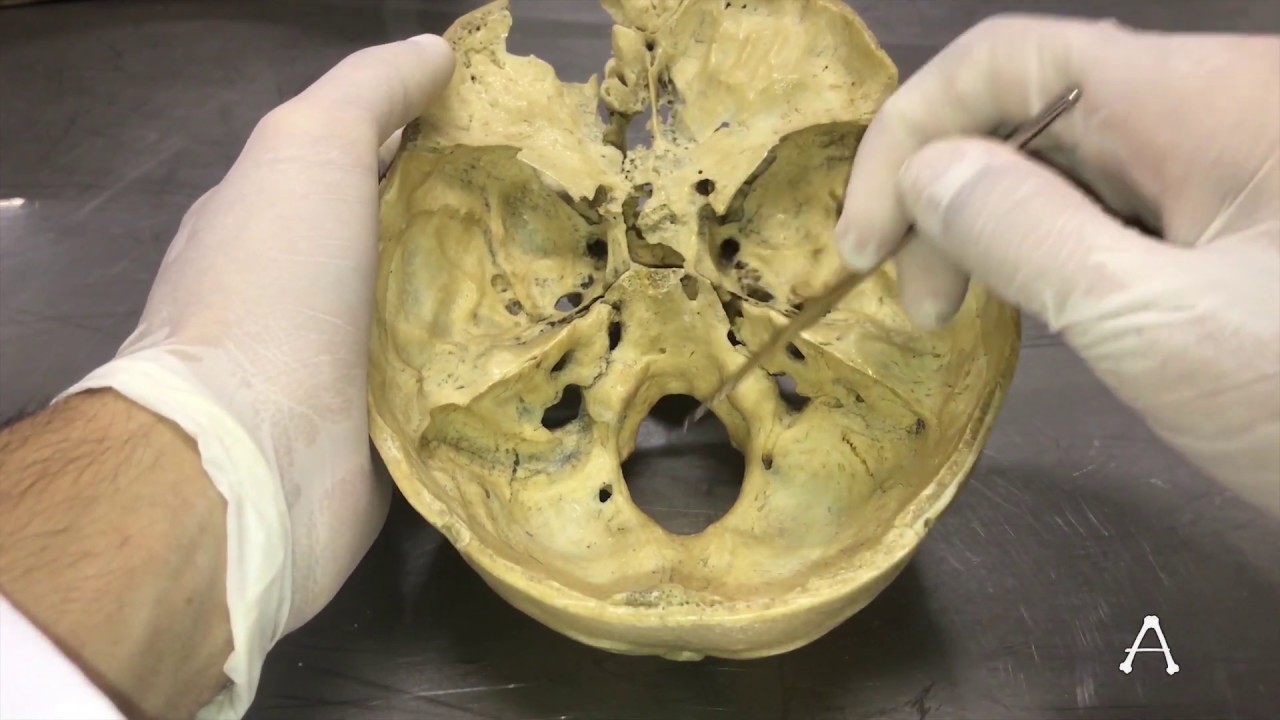 BASE DO CRÂNIO - Ossos, forames e outros acidentes anatômicos