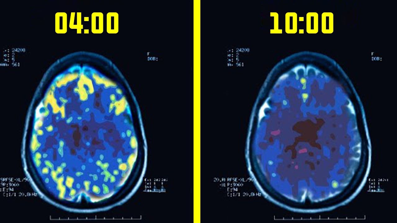 Se Réveiller à 4 Heures Du Matin