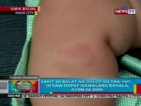 Pag-alis ng kuko plate ng fungus na nahawaan Fungal sakit ng kuko paggamot