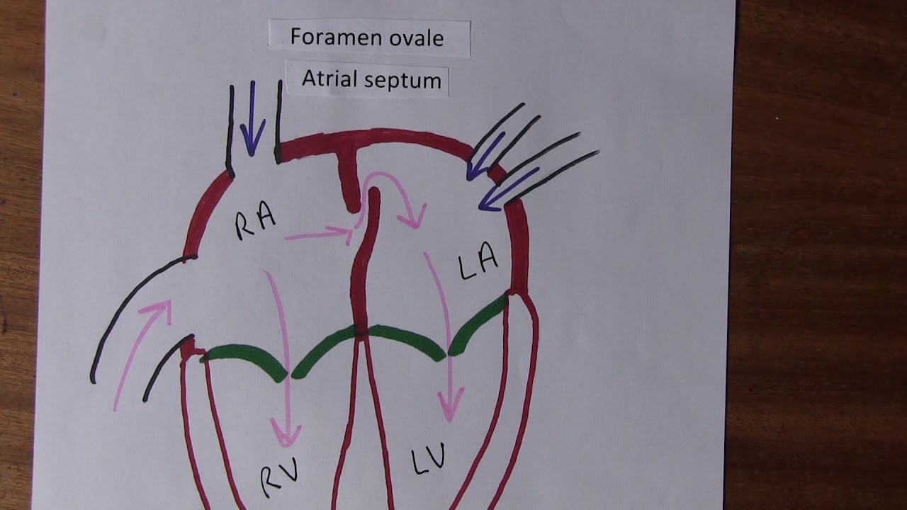 Cardiovascular System, Circulatory changes at birth - YouTube