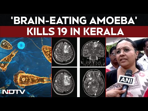 Kerala Amoeba Cases | 'Brain-Eating Amoeba' Kills 19 In Kerala. How It Spreads, How To Stay Safe