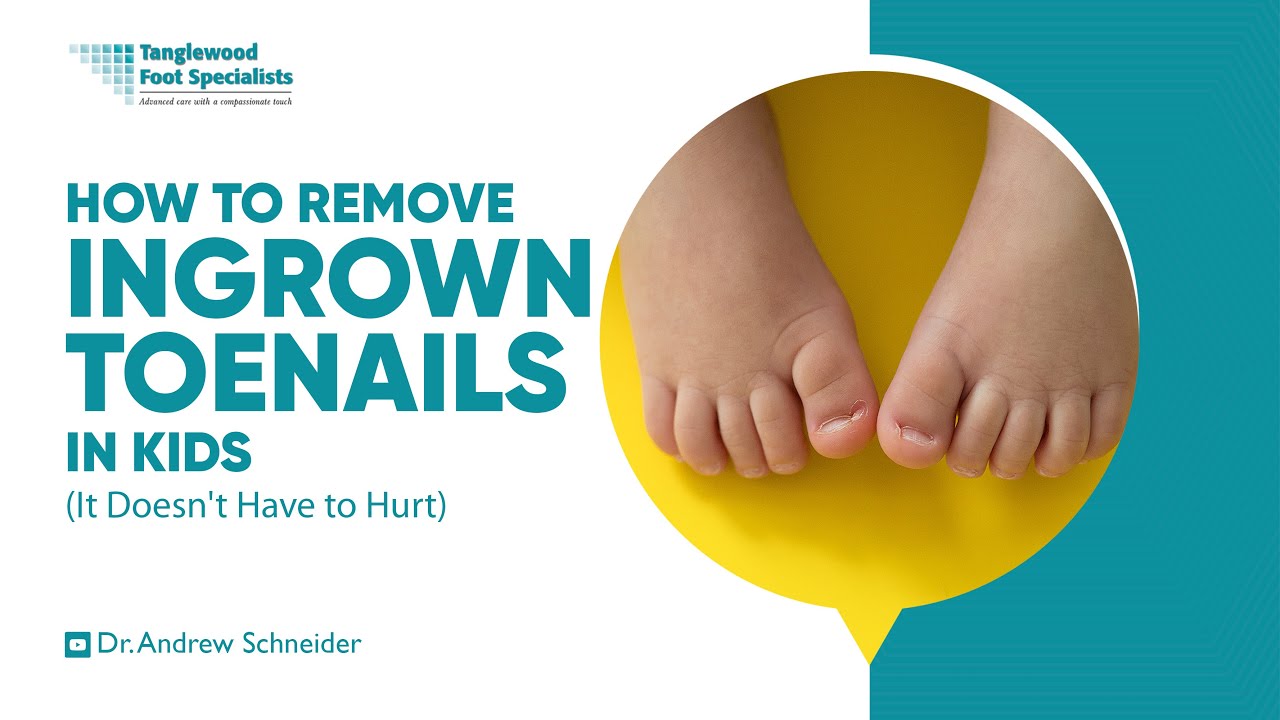 How to Remove Ingrown Toenails in Kids (It Doesn't Have to Hurt)