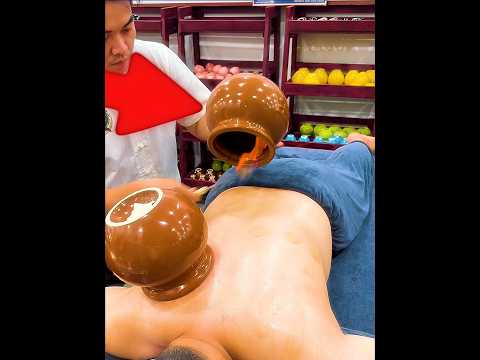 He Fell Asleep During Cupping 😳😂