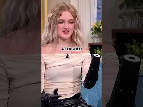Bionic Arm Real-Life Demo
