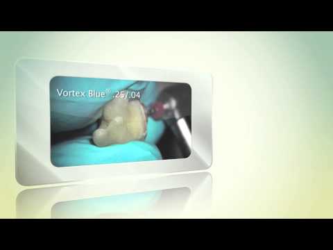 Vortex Blue® - Testimonials | Dentsply Sirona