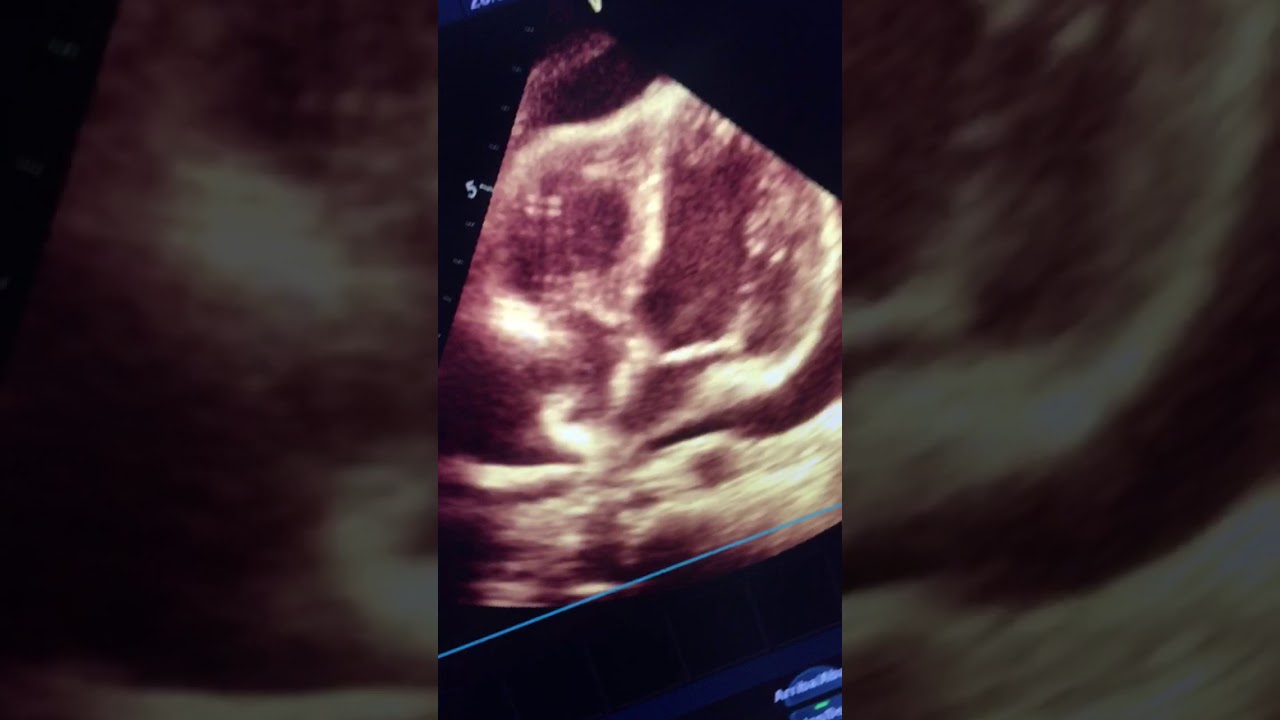 Juan De Dios Candia Camacho-28