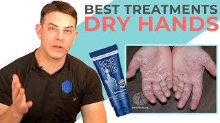 The Fix for Dry Hands! Hand Eczema