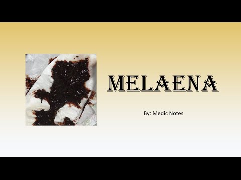 Melaena appearance, causes, mechanism, sign value
