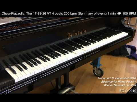 Chew-Piazzolla (1): Thu 17-38-26 VT 4 beats 200 bpm (Summary of event) 1 min HR 105 BPM