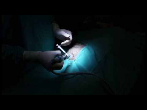 Shoulder Joint Injection - Polyglycan-SA - Canine