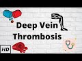Deep Vein Thrombosis Causes Signs And Symptoms Diagnosis And Treatment