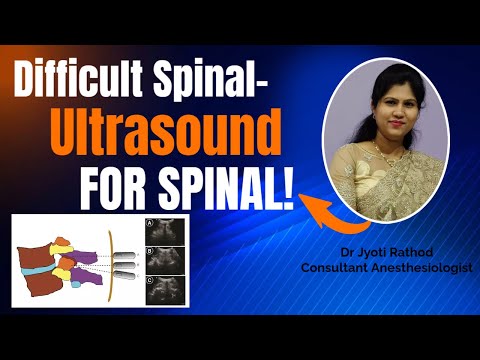Difficult Spinal I Ultrasound & C Arm Guided Spinal Anesthesia