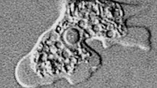 Dette er den hjernespisende og dødelige amøben